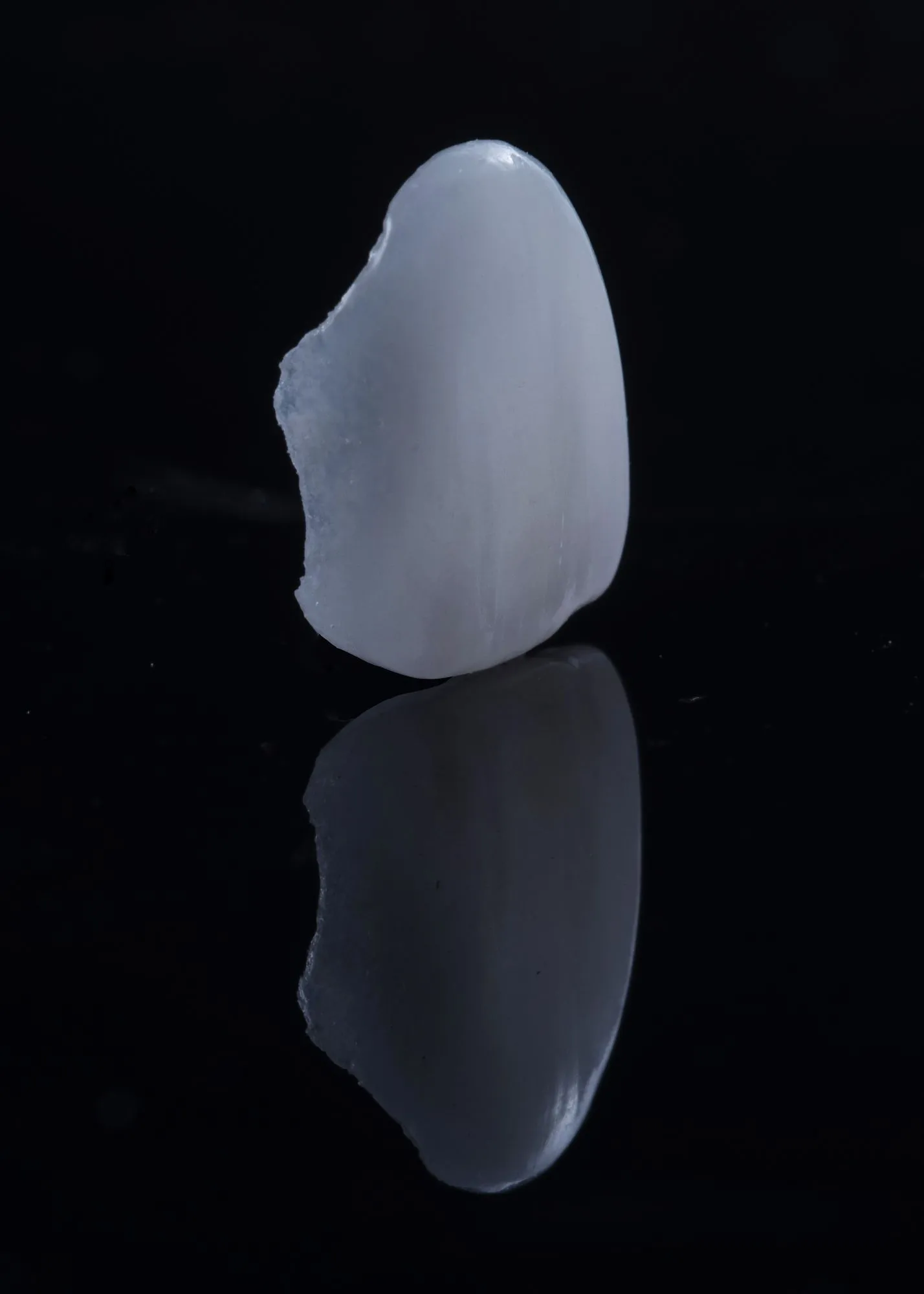 Laminate veneer treatment — natural beauty tailored to each individual patient