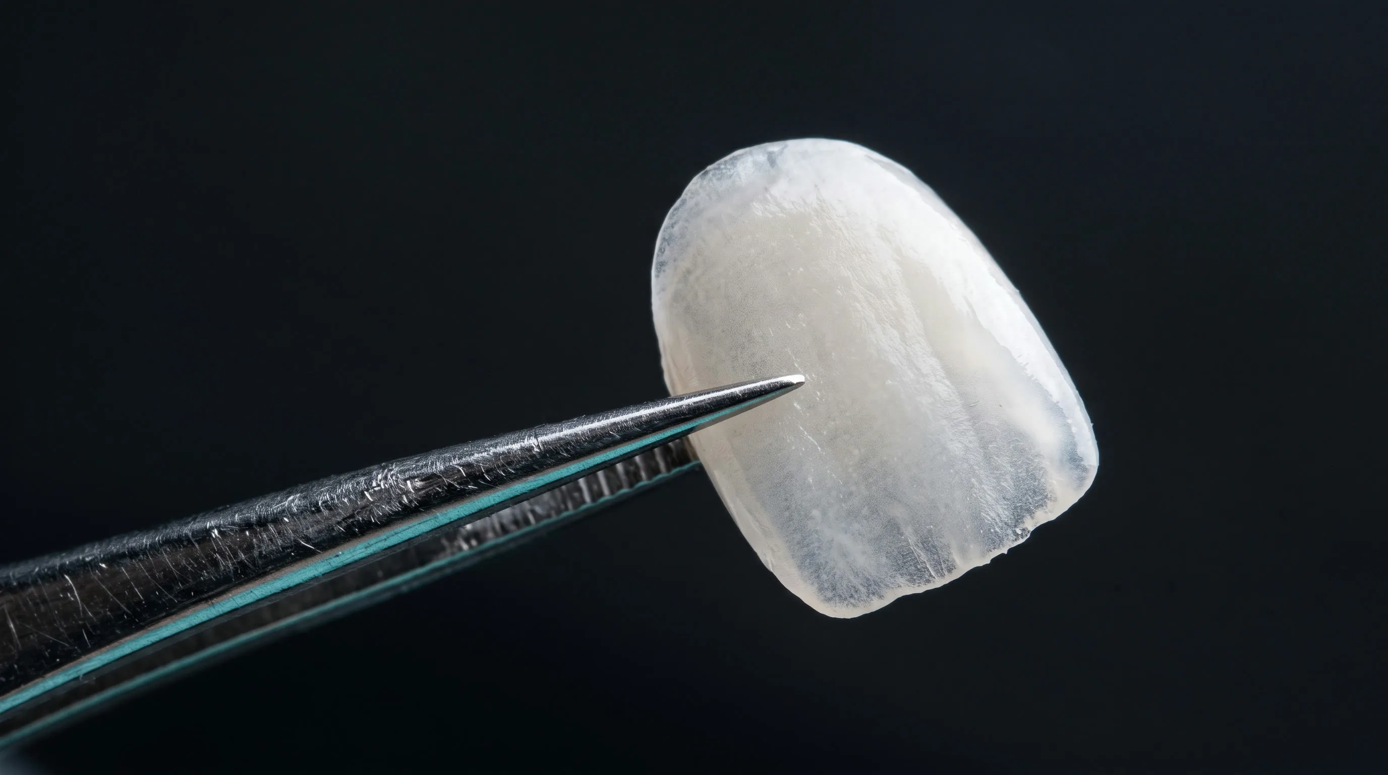 라미네이트 쉘. 0.3mm 두께의 도재 (연출 이미지)