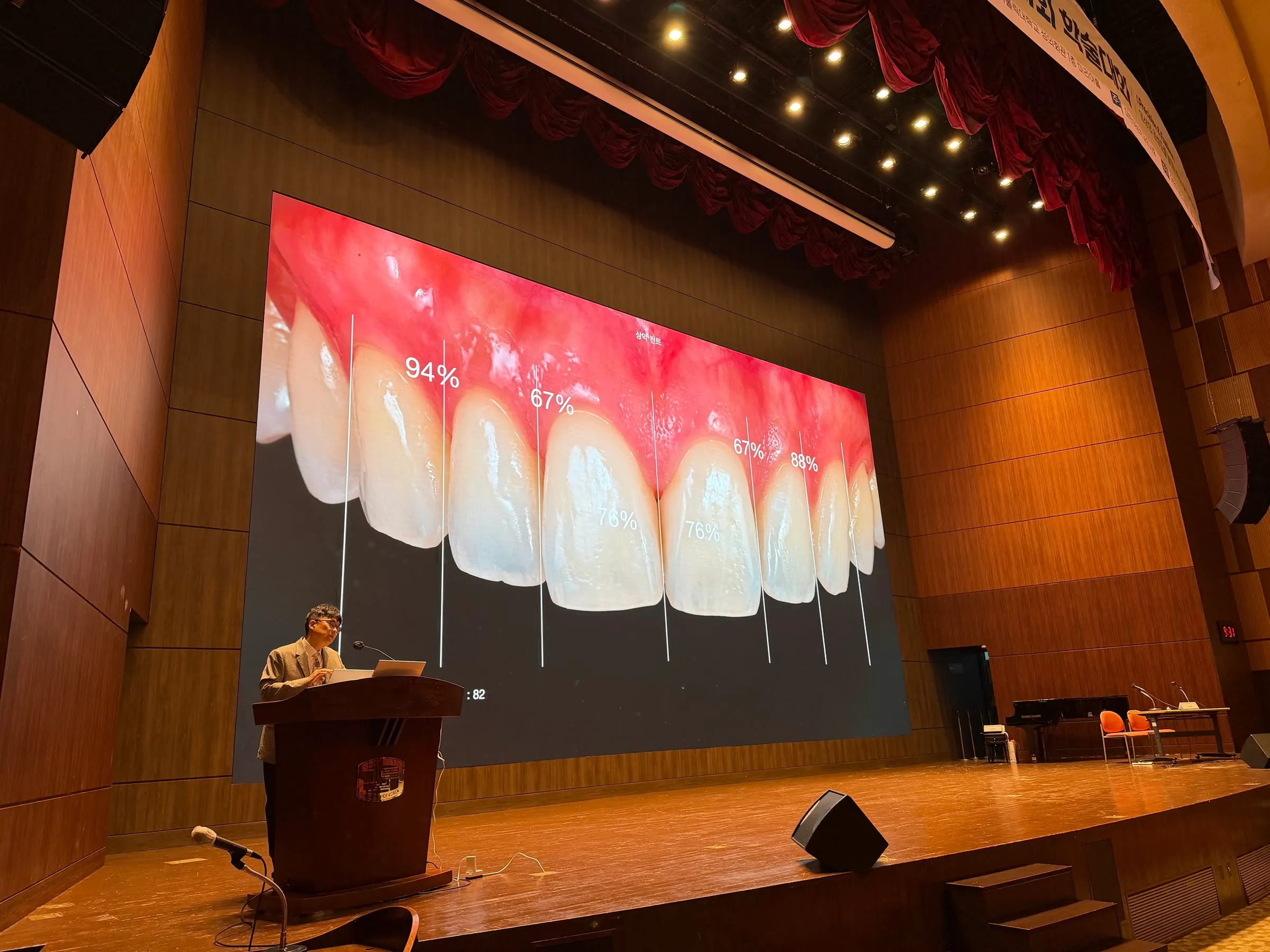 Explaining form design with a slide that marks tooth-by-tooth proportions on an upper anterior case photo