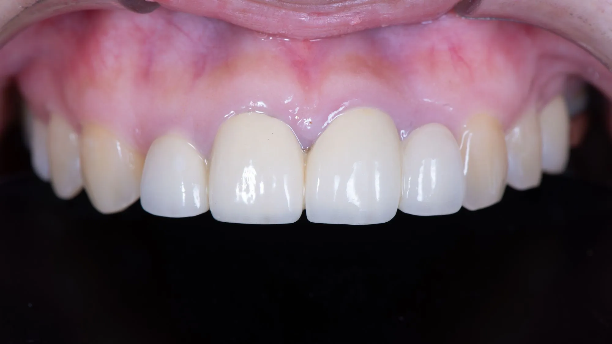 Revision case 2 — BEFORE