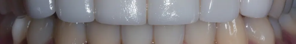Quy trình chế tác Veneer thủ công tự nhiên — ảnh 6