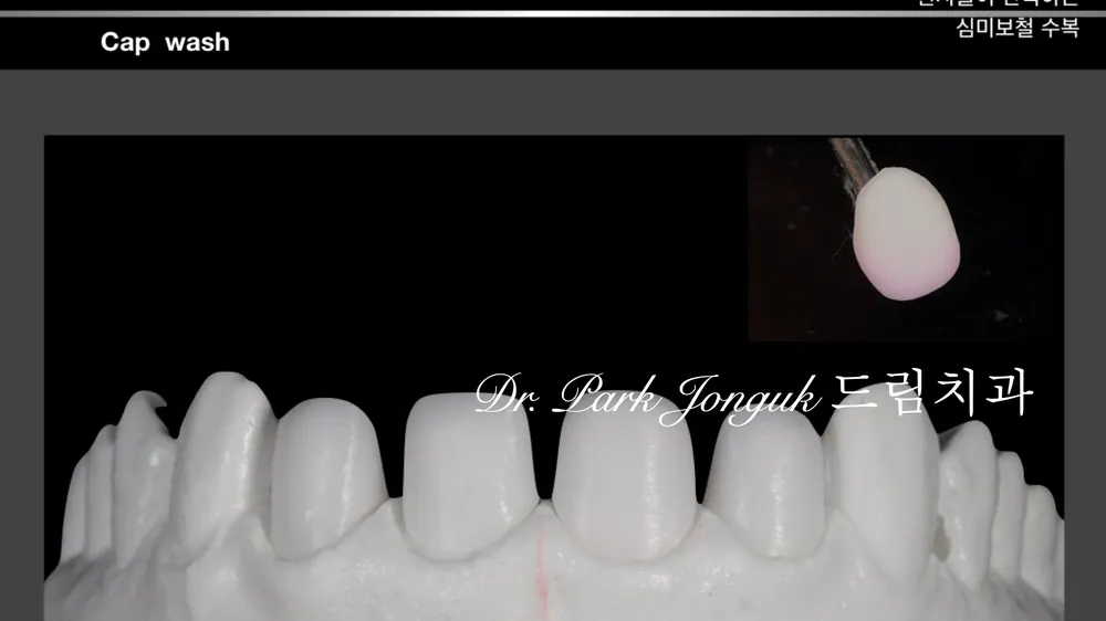 Quy trình chế tác Veneer thủ công tự nhiên — ảnh 11