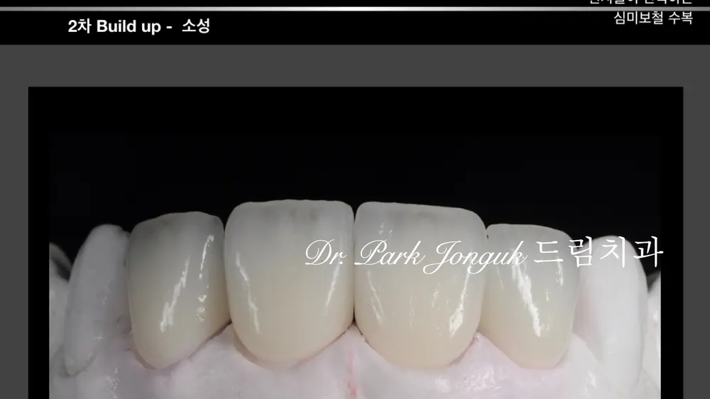 Quy trình chế tác Veneer thủ công tự nhiên — ảnh 26