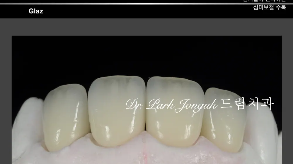 Quy trình chế tác Veneer thủ công tự nhiên — ảnh 29