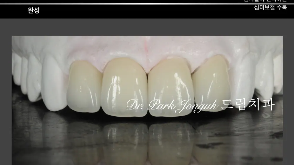 Quy trình chế tác Veneer thủ công tự nhiên — ảnh 31