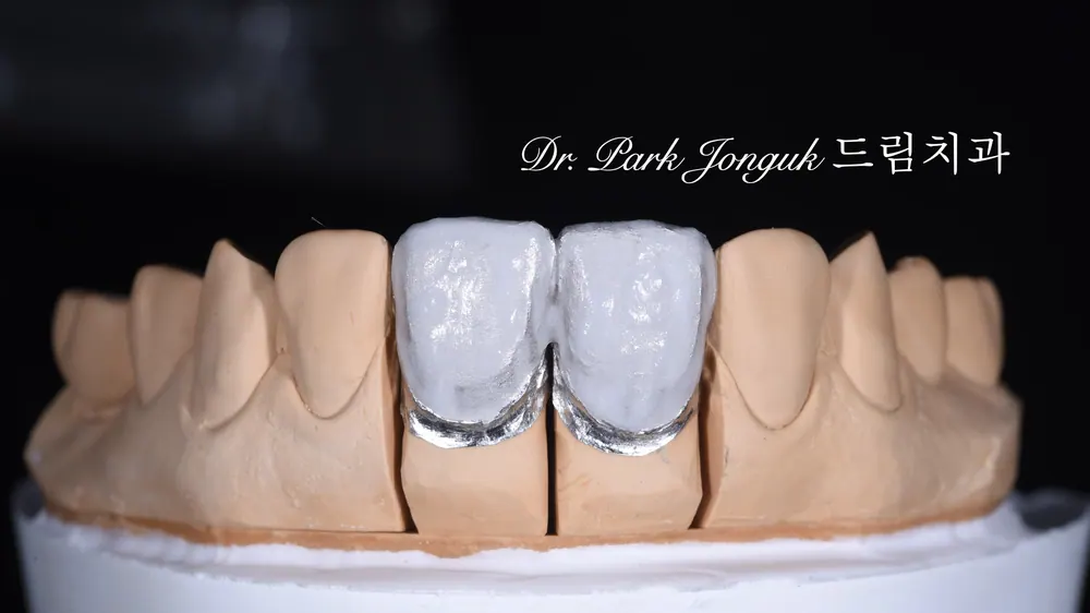 4 วิธีการผลิตวีเนียร์! — ภาพที่ 2