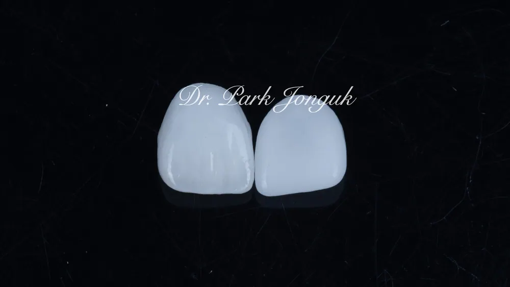依製作方法而異的陶瓷貼片成品 — 圖4