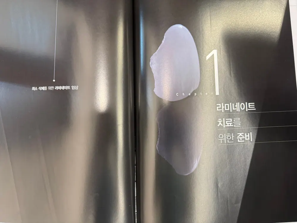 『최소 삭제를 위한 라미네이트 임상』 — 圖2