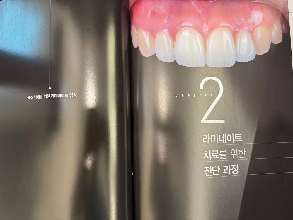 『최소 삭제를 위한 라미네이트 임상』 — 圖3