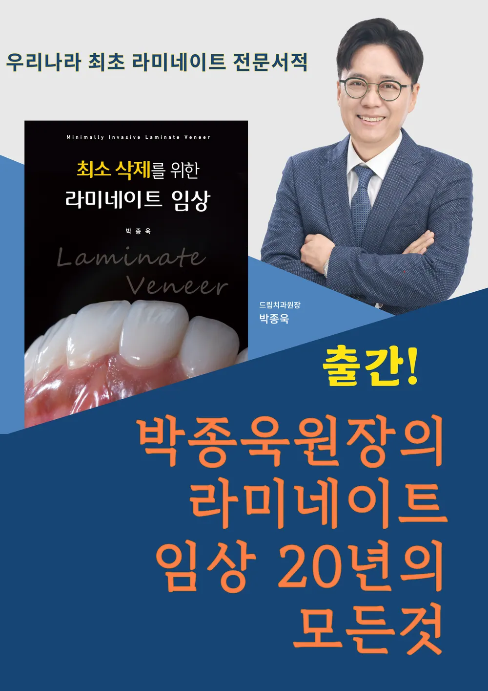라미네이트의 종류와 제작 과정간의 중요한 차이 본문 사진 16