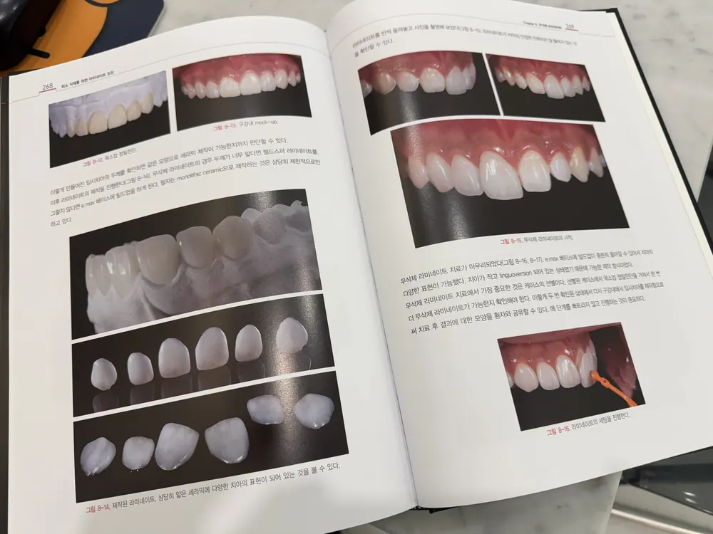 Lamista學院－陶瓷貼片實戰臨床研討會 — 圖2