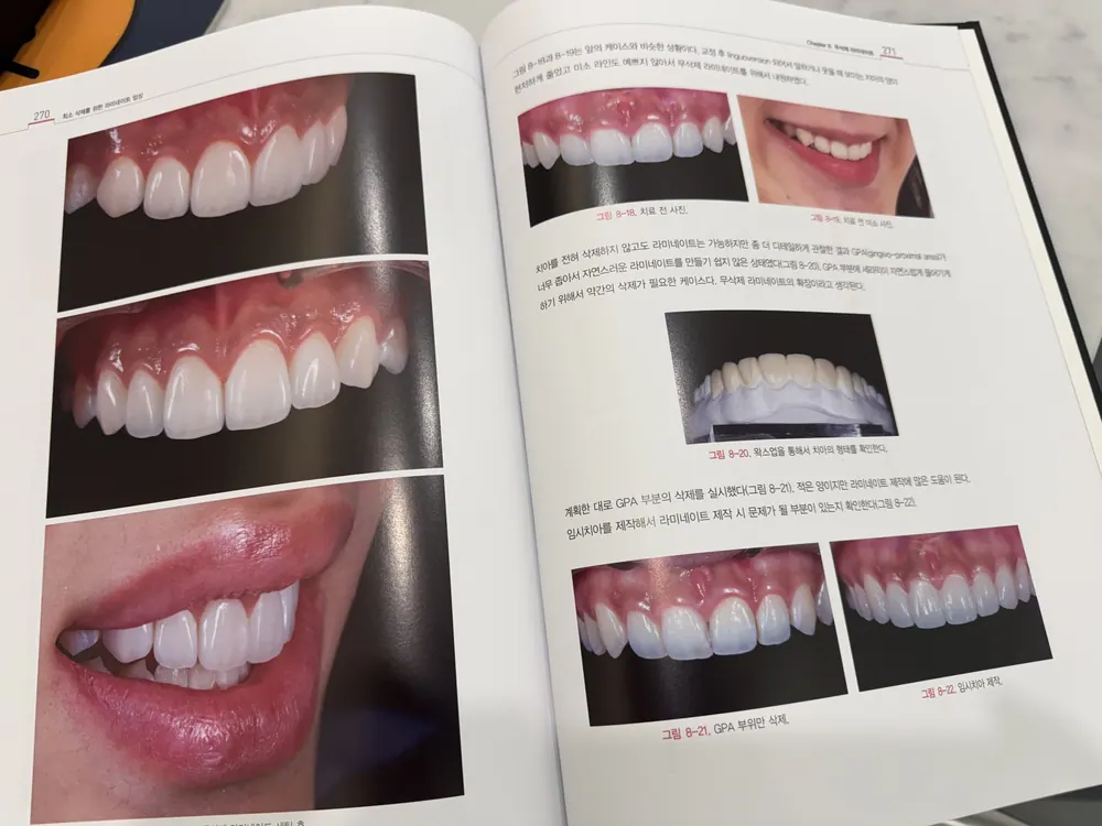 Lamista學院－陶瓷貼片實戰臨床研討會 — 圖3