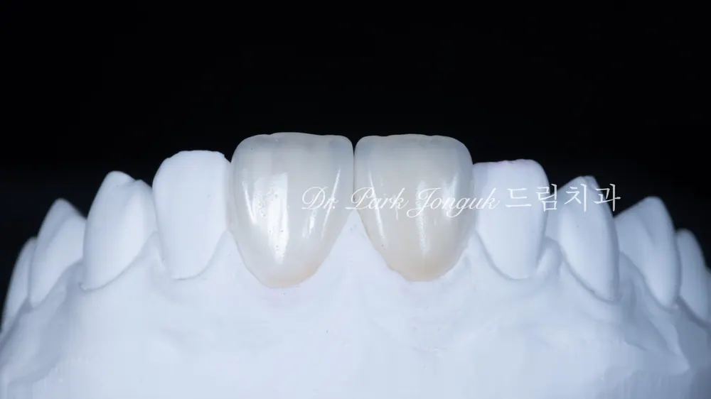 라미네이트 제작 방식, 과정에 대하여! 본문 사진 3