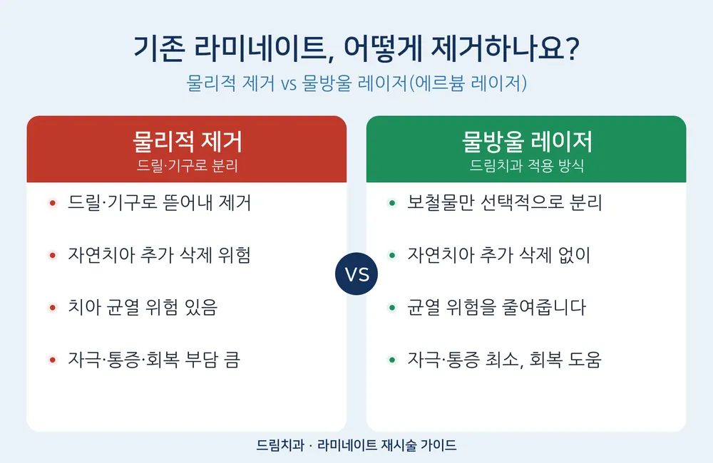 라미네이트 재시술, 다시 깎지 않고도 가능할까요? — 실패 원인부터 안전한 제거까지 본문 사진 7