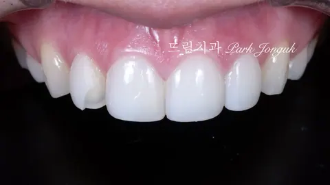 다른 곳에서 한 라미네이트, 다시 할 수 있을까요?