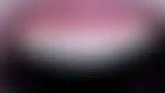 上颌4颗前牙微创磨牙瓷贴面治疗效果 — 再现与天然牙协调的色泽,20年临床之作 (已模糊处理,登录后可查看)