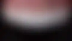 上颌6颗前牙微创磨牙瓷贴面治疗效果 — 自然通透感与前牙区的协调 (已模糊处理,登录后可查看)