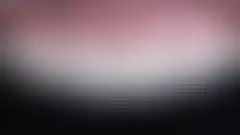上颌4颗前牙微创磨牙瓷贴面治疗效果 — 精心手工完成的堆瓷制作 (已模糊处理,登录后可查看)