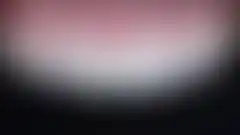 自然的瓷贴面治疗效果 — 以4~5种瓷粉多层手工堆塑制作 (已模糊处理,登录后可查看)