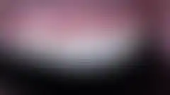 幾乎不磨牙即改善形態的免磨牙(無預備)陶瓷貼片真實臨床案例 — 治療後 (已模糊處理,登入後可查看)