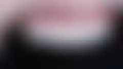CASE 01 免磨牙陶瓷貼片 — 保留自然感的美麗牙齒 — 右側面 — 確認厚度感 (已模糊處理,登入後可查看)