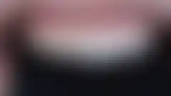 不磨牙贴面——试戴(try-in) (已模糊处理,登录后可查看)