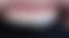 CASE 01 免磨牙陶瓷貼片 — 保留自然感的美麗牙齒 — 試戴(try-in) — 黏著前確認 (已模糊處理,登入後可查看)