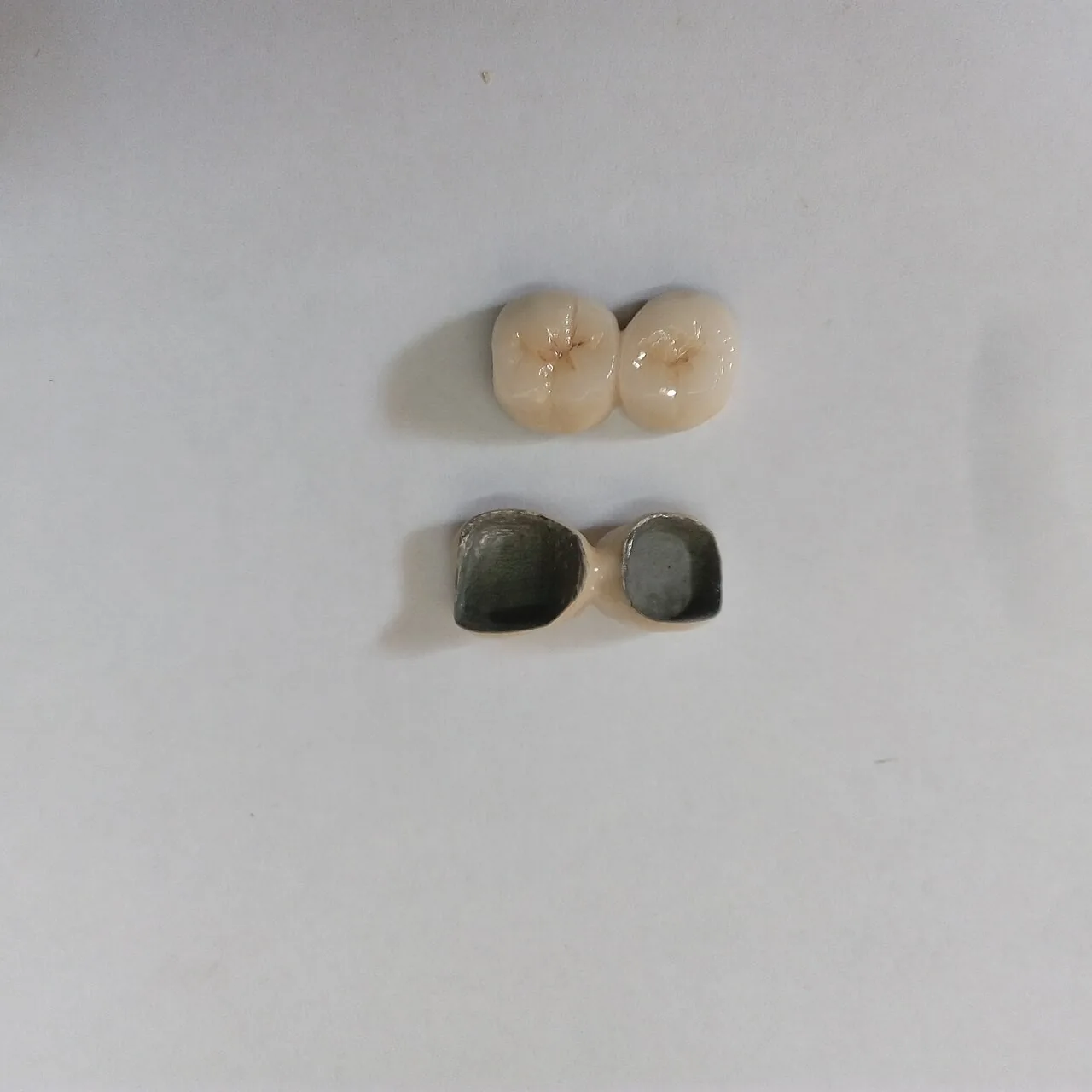 두 개 연결된 도재 크라운의 윗면과 안쪽 금속면을 흰 바탕에 놓은 사진